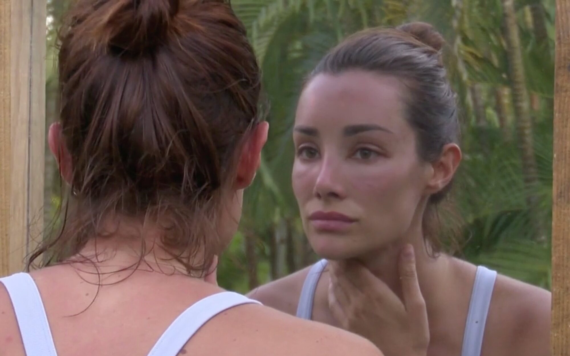 La reacción de Adara Molinero al verse la cara deformada por una alergia en 'Supervivientes': "Qué horror"